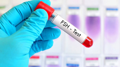 FSH Hormonu Nedir? FSH Hormonu Neden Önemlidir?