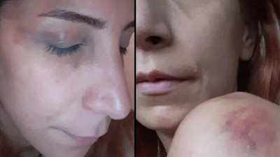 Veteriner hekim dehşeti yaşadı: İşkence, sadistlik boyutundaydı