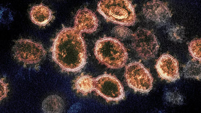 Eksikliği koronavirüsten ani ölüme neden olabilen vitamin açıklandı