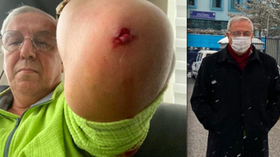 Gazeteci Orhan Uğuroğlu'na saldıran kişinin nerede çalıştığı ortaya çıktı