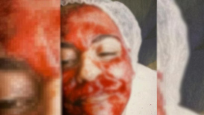 Güzellik merkezinde korkunç olay: Kadının yüzü kanlar içinde kaldı