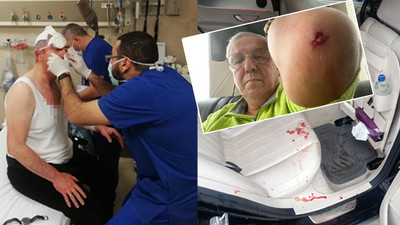 MHP'li Yıldıray Çiçek, saldırıya uğrayan gazetecileri suçladı: Üç yumruk için ortalığı ayağa kaldırıyorlar