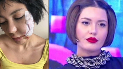 Bahar Candan'ın yüzünü yaralayan kişi serbest bırakıldı