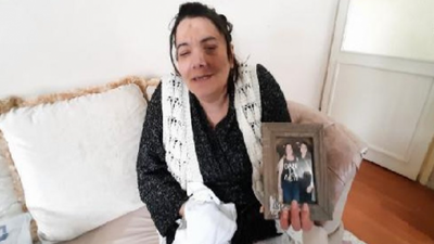 Damak tedavisinde sinir kesilince yüz felci oldu