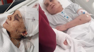 'Kadın kısmı çalışmaz' diyerek eşine satırla saldırdı