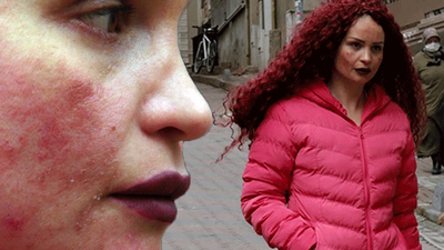 Yüzündeki lekeleri sildirmek için gitti, hayatının şokunu yaşadı