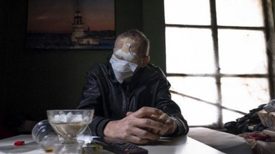 Burnunda çıkan siğil hayatını kararttı: Yüzünü kaybetti...