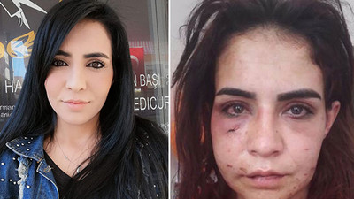 Kendisini bayıltana kadar darp eden erkek savcılık talimatıyla serbest bırakıldı