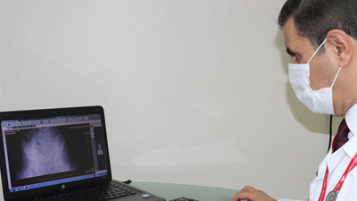 Küçük kızın midesinden mandal çıktı