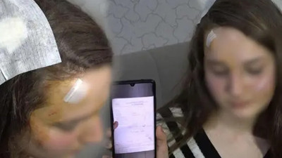 Muşta ile genç kıza saldırdı, 'başkasına benzettim' dedi