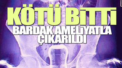 Hacamat ile basur tedavisinde şoke eden olay