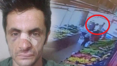 Maske uyarısı yapan market çalışanının burnunu kırdı