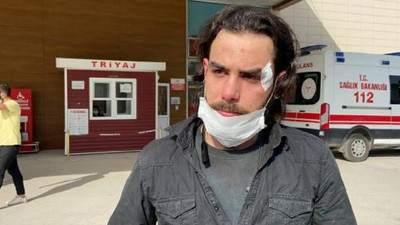 Patron şiddeti: 1000 tl alacağını isteyen işçisini darp etti