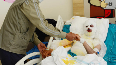 Üzerine yıldırım düşen çoban feci şekilde yaralandı