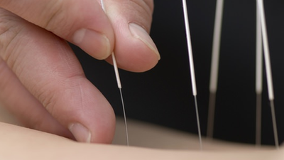 'Alternatif tıp' işkencesi: Beline delik açıp, deri altından çamaşır ipi geçirmişler