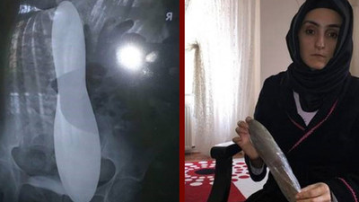 Ameliyat sonrası hayatının şokunu yaşadı: Karnında mala unutuldu