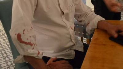 CHP’li belediye başkanına beyzbol sopalı saldırı