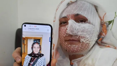 Eşinin kızgın yağ ile yaktığı kadın: Ölmek istemiyorum