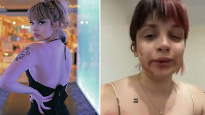 Fenomen Başak Ermiş, tayt giydiği için öldüresiye darp edildi