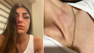 Eski sevgilisinden genç mankene öldüresiye darp