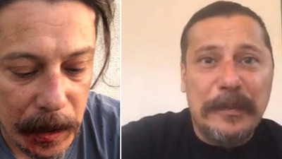 Gazeteciye bıçaklı yumruklu saldırının ardından şimdi de tehdit mesajı