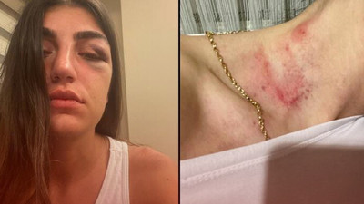 Genç mankene gece kulübünde feci dayak