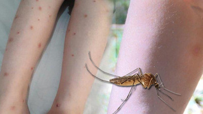 İstanbul’da bir çok ilçede görüldü: İBB uyardı