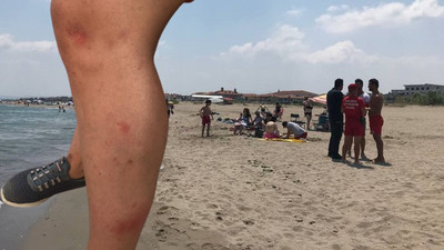 Karadeniz'de panik! Denize girenlerdeki kızarıklığın nedeni belli oldu 