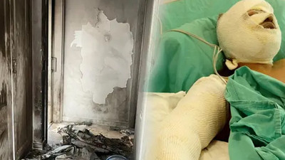 Kayınvalidesinin üzerine benzin döküp yaktı