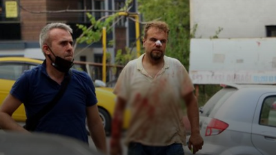 Kurban yerine parmağını kesti