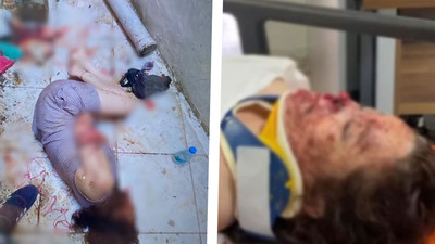 Kadıköy'de korkunç olay: Kanlar içinde bulundu