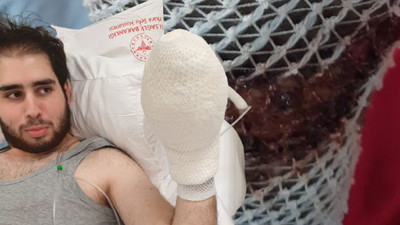 Piknik yapan genç az daha canından oluyordu