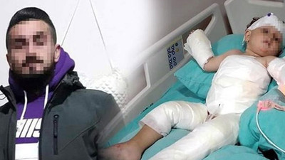 Eşi ve 1.5 yaşındaki oğlunu üzerlerine kolonya dökerek yakan babanın ilk ifadesi ortaya çıktı