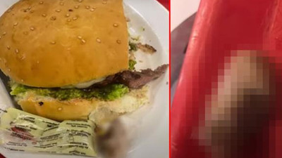 Mide bulandıran olay: Hamburgerden insan parmağı çıktı