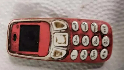 Nokia 3310 yutan adam ameliyat edildi, telefon midesinden çıkarıldı