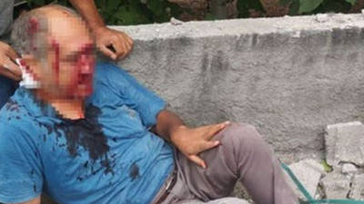 Yolda yürüyen yurttaş bir anda kanlar içinde kaldı