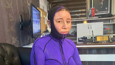 Eşini benzin dökerek yakan kocanın ifadeleri kan dondurdu: Senin ateşinle ısınayım