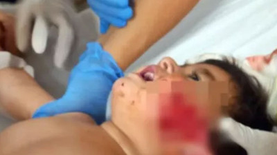 Pitbull dehşeti: Bebeğin yanağını ve kulağını kopardı