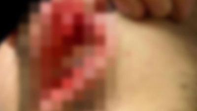 Doktora akıl almaz saldırı: Müdahale ettiği hastanın yakını tarafından darp edildi