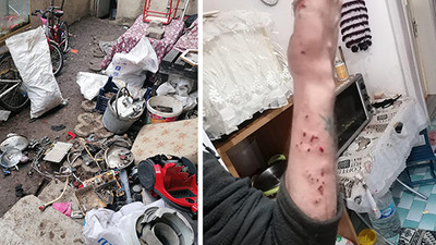 Akılalmaz olay! Hurdaları ayırırken el bombası fünyesi patladı