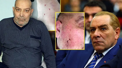 Atatürk'e benzerliğiyle tanınan Göksal Kaya eşinden şiddet gördüğünü açıkladı