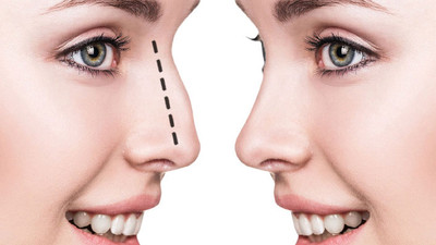 Burun Estetiği Ameliyatları Neden Çok Tercih Ediliyor?