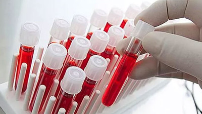 Kan grupları arasında hastalıklara karşı en dirençli kan grubu ortaya çıktı!