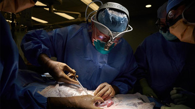 Milyonlarca hastaya umut veren gelişme: Domuz böbreği insana nakledildi