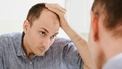 Saç Ekimi Başarı Oranı Nedir?