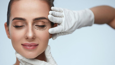 Üst Göz Kapağı Estetik Ameliyatı