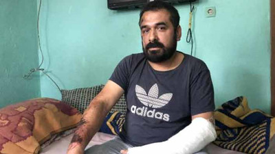 Yaralı madenci: Baret, lamba hiçbir şey kalmamıştı