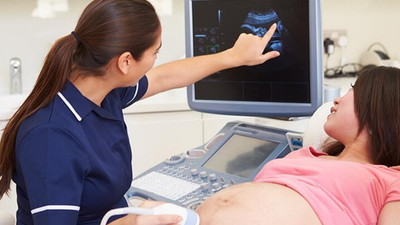 50 milyonda bir ihtimal gerçek oldu: 2 rahminden de hamile kaldı