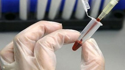 Akciğer kanserini önceden tespit edebilen test geliştirildi