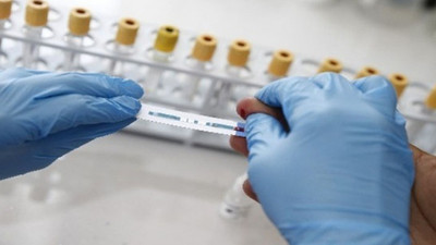 Avrupa'da hızla yayılıyor: Yeni HIV/AIDS mutasyonu